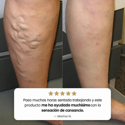 Parches Varices™ Alivio Diario, Sensación de Ligereza y Bienestar Desde la Primera Aplicación