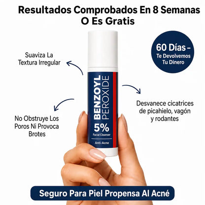 Remodelador de Cicatrices de Acné®